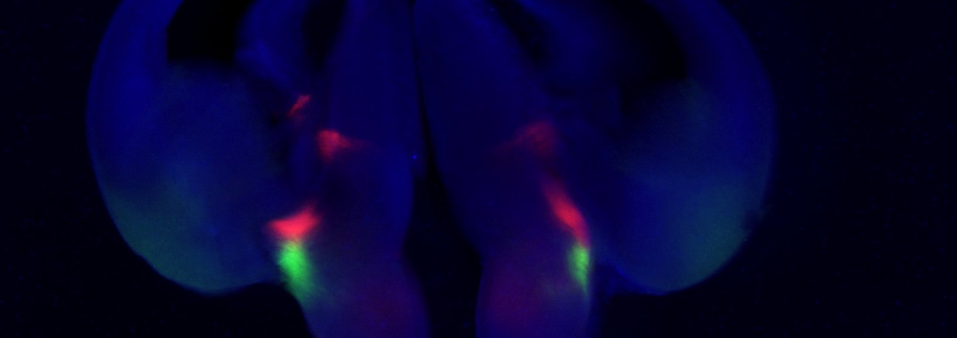 Departament de Ciències Mèdiques Bàsiques Departament de Ciències Mèdiques Bàsiques